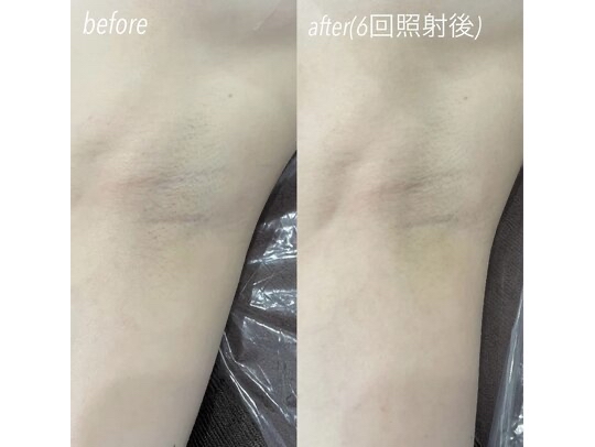 今すぐ予約！まずはお問い合わせを