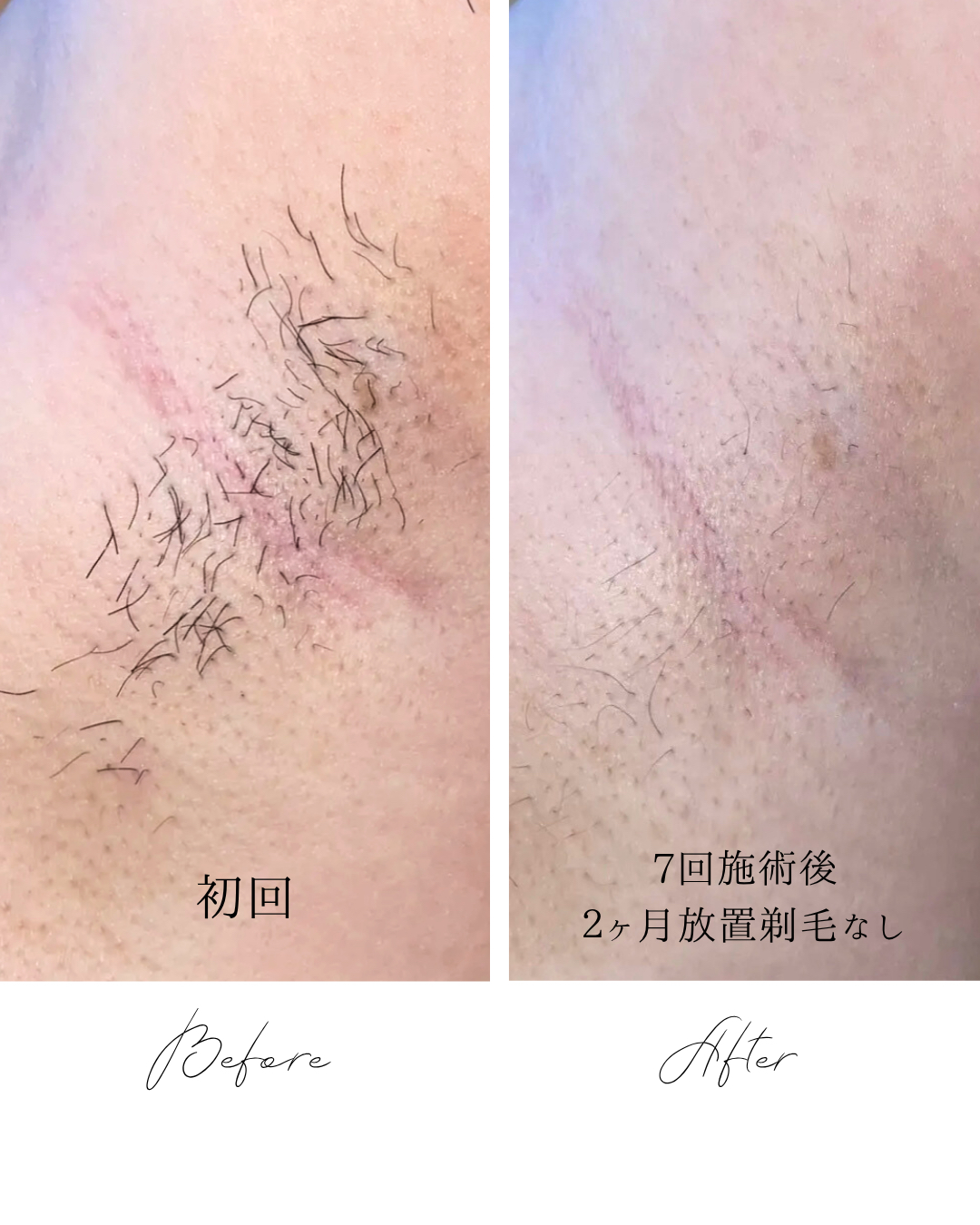 お客様の声・ビフォーアフター